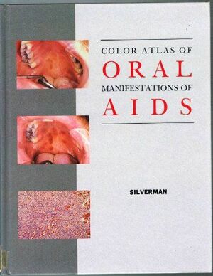 COLOR ATLAS OF ORAL MANIFESTATIONS OF AIDS