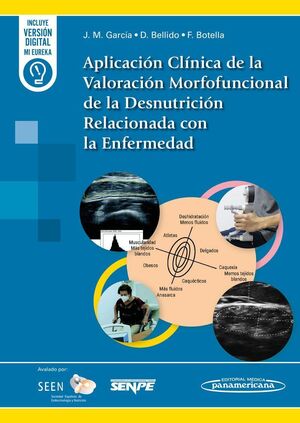 APLICACIÓN CLÍNICA DE LA VALORACIÓN MORFOFUNCIONAL DE LA DESNUTRICIÓN RELACIONAD