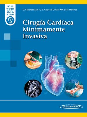 CIRUGÍA CARDÍACA MÍNIMAMENTE INVASIVA