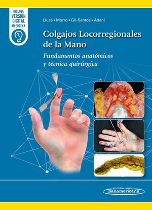 COLGAJOS LOCORREGIONALES DE LA MANO:FUNDAMENTOS ANATOMICOS