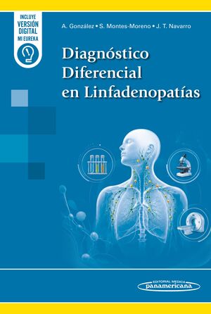 DIAGNOSTICO DIFERENCIAL EN LINFADENOPATIAS