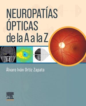 NEUROPATÍAS ÓPTICAS DE LA A A LA Z