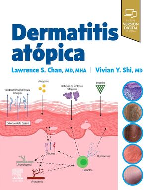 DERMATITIS ATÓPICA