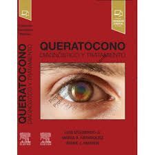 QUERATOCONO