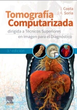 TOMOGRAFÍA COMPUTARIZADA DIRIGIDA A TÉCNICOS SUPERIORES EN IMAGEN PARA EL DIAGNÓ
