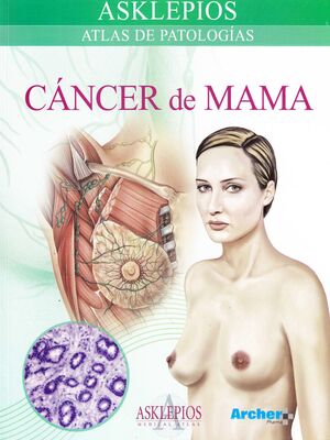 CANCER DE MAMA. ATLAS DE PATOLOGIAS