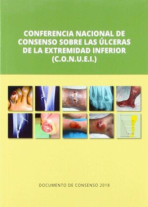 CONFERENCIA NACIONAL DE CONSENSO SOBRE LAS ULCERAS DE LA EXTREMIDAD