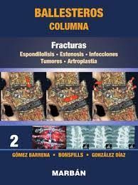 COLUMNA 2. FRACTURAS.