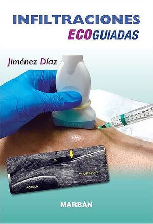 HANDBOOK DE INFILTRACIONES ECOGUIADAS. MSK.