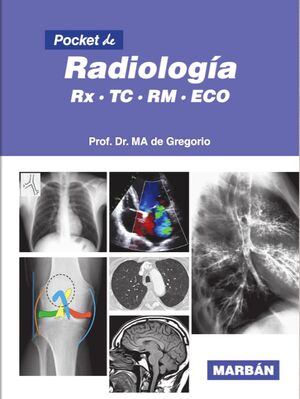 RADIOLOGÍA RX TC RM ECO (POCKET)