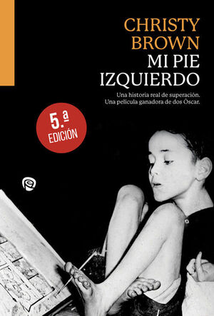 MI PIE IZQUIERDO