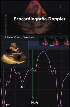 ECOCARDIOGRAFIA - DOPPLER