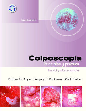 COLPOSCOPIA. PRINCIPIOS Y PRÁCTICA + DVD-ROM
