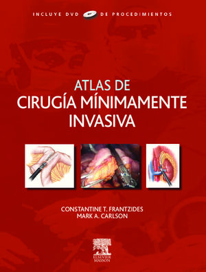 ATLAS DE CIRUGIA MINIMAMENTE INVASIVA