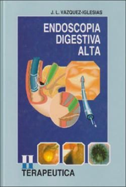 ENDOSCOPIA DIGESTIVA ALTA  II TERAPÉUTICA