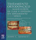 TRATAMIENTO ORTODONCICO DE LA MALOCLUSION DE CLASE II DIVISION I