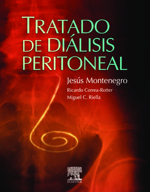 TRATADO DE DIALISIS PERITONEAL