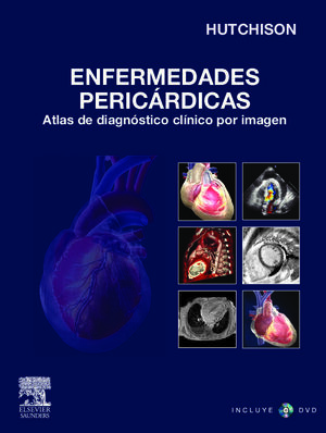 ENFERMEDADES PERICARDICAS, ATLAS DE DIAGNOSTICO CLINICO POR IMAGEN