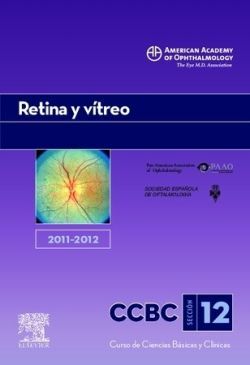 RETINA Y VITREO