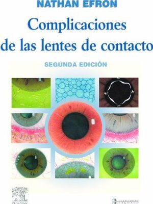 COMPLICACIONES DE LAS LENTES DE CONTACTO