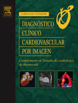 DIAGNOSTICO CLINICO CARDIOVASCULAR POR IMAGEN. COMPL. AL TRA.BRAUNWALD
