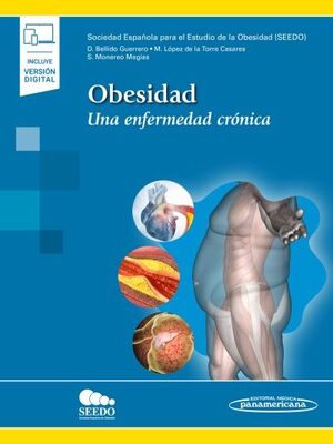 OBESIDAD (+ E-BOOK)