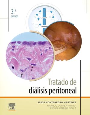 TRATADO DE DIÁLISIS PERITONEAL. 3ª ED.