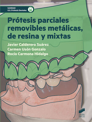 PROTESIS PARCIALES REMOVIBLES METALICAS DE RESINA Y MIXTAS