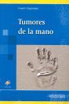 TUMORES DE LA MANO