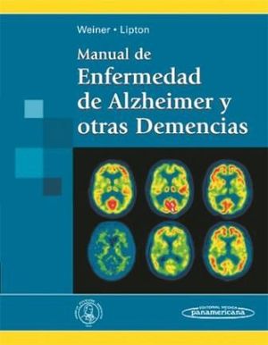 MANUAL DE ENFERMEDAD DE ALZHEIMER Y OTRAS DEMENCIAS