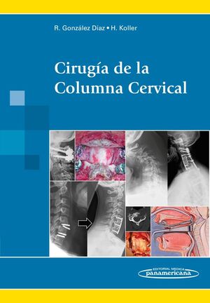 GONZALEZ:CIRUG?A COLUMNA CERVICAL