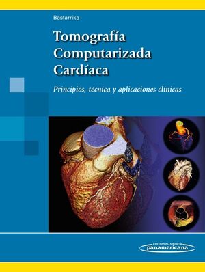TOMOGRAFIA COMPUTARIZADA CARDIACA