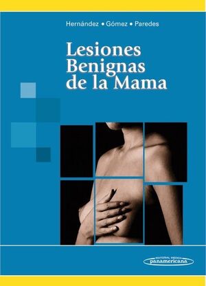 LESIONES BENIGNAS DE LA MAMA