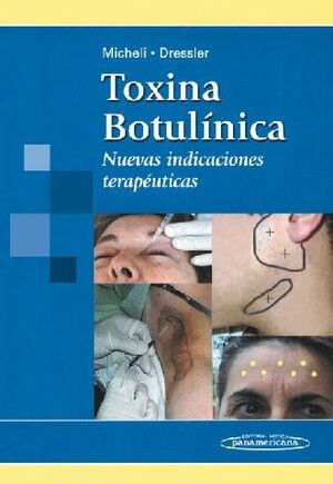 TOXINA BOTULINICA. NUEVAS INDICACIONES TERAPEUTICAS