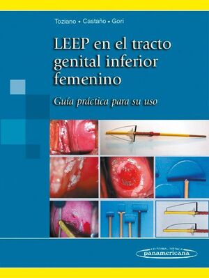 LEEP EN EL TRACTO GENITAL INFEROR FEMENINO. GUÍA PRÁCTICA PARA SU USO