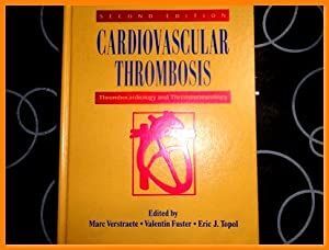 TROMBOSIS CARDIOVASCULAR