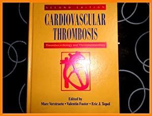 TROMBOSIS CARDIOVASCULAR