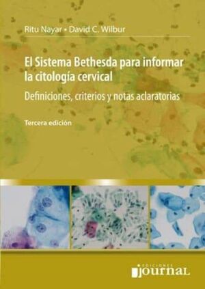 EL SISTEMA BETHESDA PARA INFORMAR LA CITOLOGÍA CERVICAL. DEFINICIONES, CRITERIOS